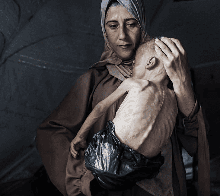 Gazze’nin Sessiz Çığlığı: Çocuklar Açlıktan Ölüyor. Gazze Şeridi, İsrail’in 7